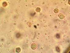 Camarophyllopsis foetens