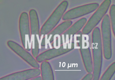 Mitrula paludosa