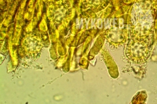 Lamprospora crechqueraultii